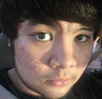 thebrainfreezymachine