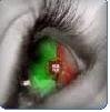 sporteecrystal