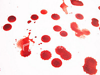 Red Rain
