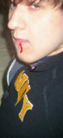 Xeris