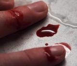 Bloodyfingers