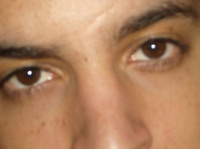 GgRedx