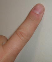 stinky finger