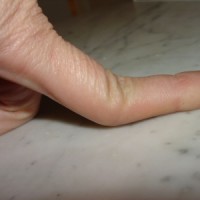 Finger_smash